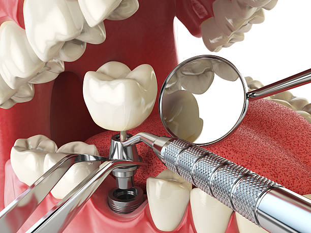 Best Weekend Emergency Dentist in Rutherford College, NC