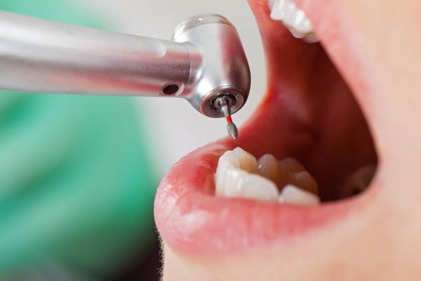 Best Emergency Dental Surgery in Rutherford College, NC